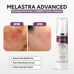 Melastra Advanced Pigmentation Correction Cream