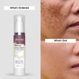 Melastra Advanced Pigmentation Correction Cream