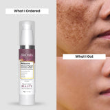 Melastra Advanced Pigmentation Correction Cream