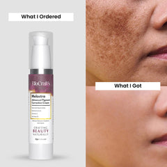 Melastra Advanced Pigmentation Correction Cream