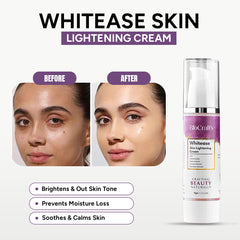 Whitease Skin Lightening Cream